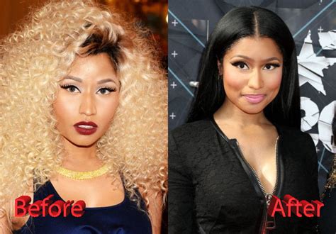 nicki minaj before photos|nicki minaj before operation.